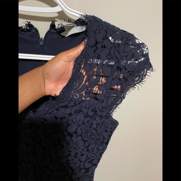 H&M dress - Picture 5 of 6